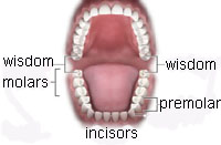 wisdom teeth